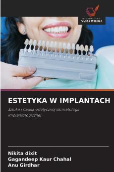 ESTETYKA W IMPLANTACH