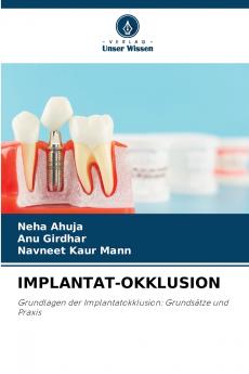 IMPLANTAT-OKKLUSION