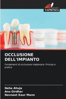 OCCLUSIONE DELL'IMPIANTO