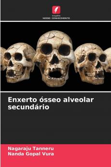 Enxerto ósseo alveolar secundário
