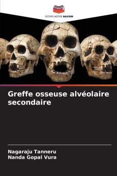 Greffe osseuse alvéolaire secondaire