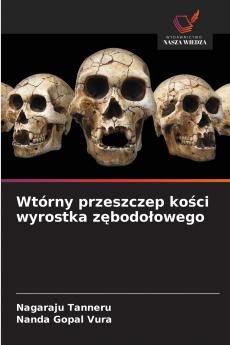 Wtórny przeszczep kości wyrostka zębodołowego