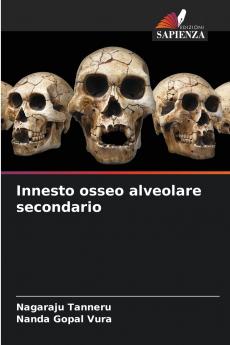 Innesto osseo alveolare secondario
