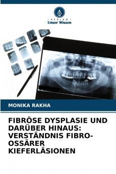 FIBRÖSE DYSPLASIE UND DARÜBER HINAUS