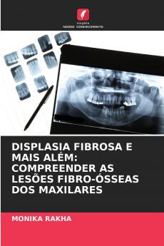 DISPLASIA FIBROSA E MAIS ALÉM