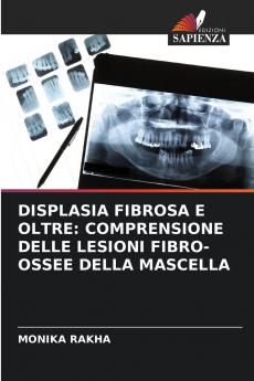 DISPLASIA FIBROSA E OLTRE