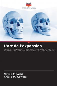 L'art de l'expansion
