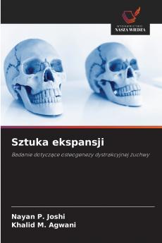 Sztuka ekspansji