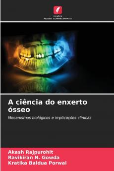 A ciência do enxerto ósseo