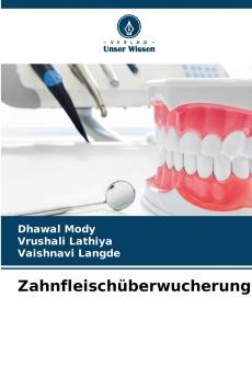 Zahnfleischüberwucherung