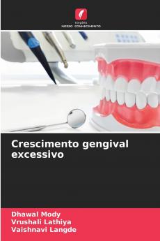 Crescimento gengival excessivo