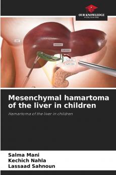 Mesenchymal hamartoma of the liver in children