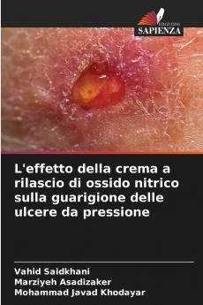 L'effetto della crema a rilascio di ossido nitrico sulla guarigione delle ulcere da pressione