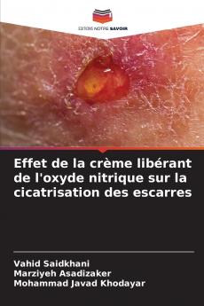 Effet de la crème libérant de l'oxyde nitrique sur la cicatrisation des escarres