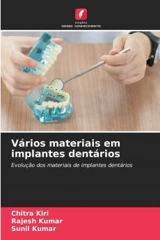 Vários materiais em implantes dentários