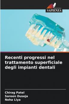 Recenti progressi nel trattamento superficiale degli impianti dentali