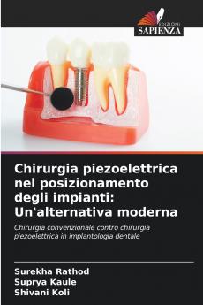 Chirurgia piezoelettrica nel posizionamento degli impianti