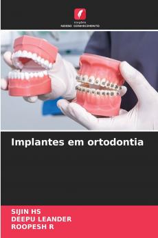 Implantes em ortodontia