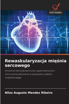 Rewaskularyzacja mięśnia sercowego