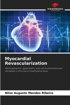 Myocardial Revascularization