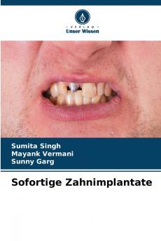 Sofortige Zahnimplantate