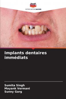 Implants dentaires immédiats