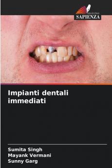 Impianti dentali immediati