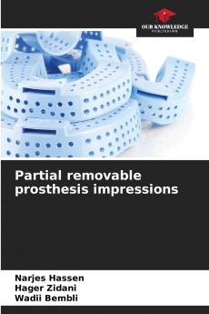 Partial removable prosthesis impressions