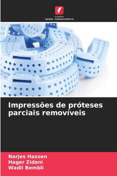 Impressões de próteses parciais removíveis