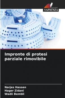 Impronte di protesi parziale rimovibile