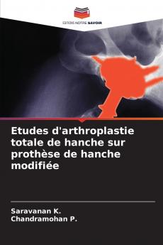 Etudes d'arthroplastie totale de hanche sur prothèse de hanche modifiée