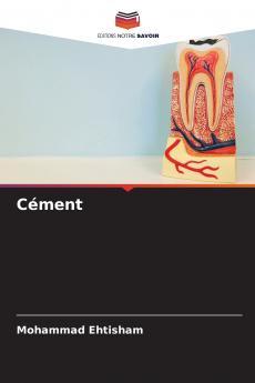 Cément