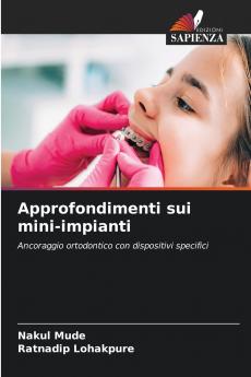 Approfondimenti sui mini-impianti