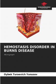 HEMOSTASIS DISORDER IN BURNS DISEASE