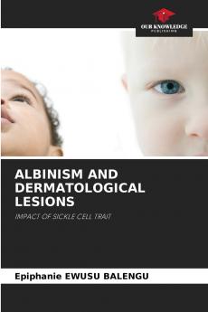 ALBINISM AND DERMATOLOGICAL LESIONS