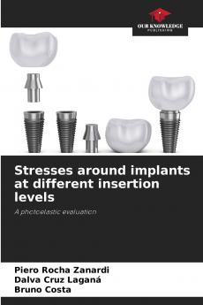 Stresses around implants at different insertion levels