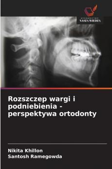 Rozszczep wargi i podniebienia - perspektywa ortodonty