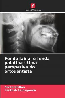 Fenda labial e fenda palatina - Uma perspetiva do ortodontista