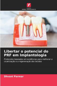 Libertar o potencial do PRF em Implantologia