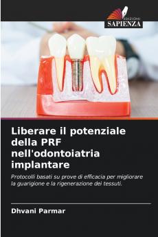 Liberare il potenziale della PRF nell'odontoiatria implantare