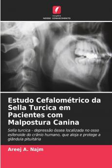 Estudo Cefalométrico da Sella Turcica em Pacientes com Malpostura Canina