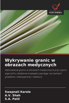 Wykrywanie granic w obrazach medycznych