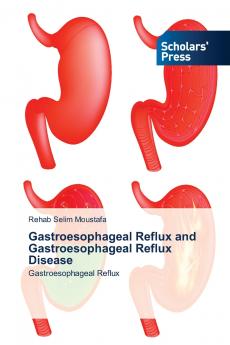 Gastroesophageal Reflux and Gastroesophageal Reflux Disease