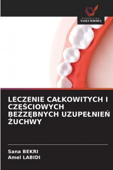 LECZENIE CAŁKOWITYCH I CZĘŚCIOWYCH BEZZĘBNYCH UZUPEŁNIEŃ ŻUCHWY