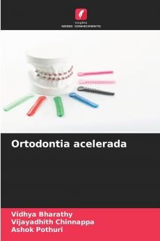 Ortodontia acelerada
