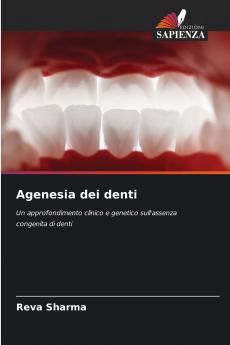 Agenesia dei denti