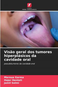 Visão geral dos tumores hiperplásicos da cavidade oral