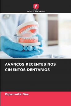 AVANÇOS RECENTES NOS CIMENTOS DENTÁRIOS