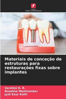 Materiais de conceção de estruturas para restaurações fixas sobre implantes