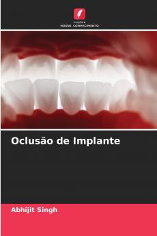 Oclusão de Implante